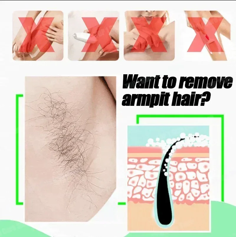 제모 스프레이 강력한 제모 효과 건강하고 통증 없는 제 - Hair Care Korea 리뷰 및 가격