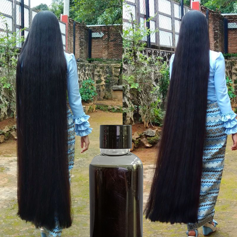 중국어 허브 헤어 케어 모발 성장 제품 50ml 손으로 - Hair Care Vegetables 리뷰 및 가격