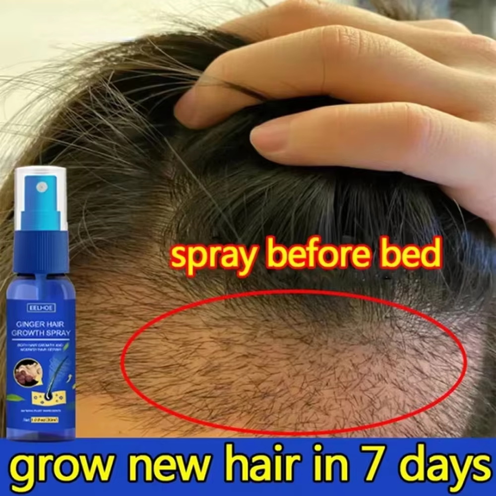빠른 생강 모발 성장 스프레이, 모발 뿌리 강화, 탈모 - Hair Care Natur 리뷰 및 가격